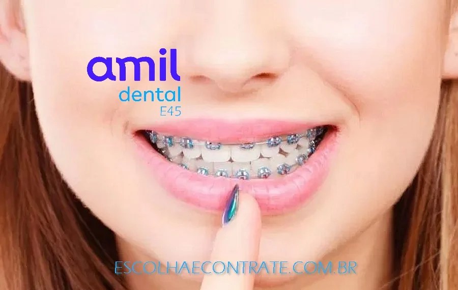 Amil Dental E45 cobre aparelho,documentações e manutenções ortodônticas ! 5 (2)